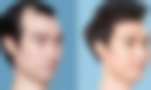 优惠活动详情与FAQ