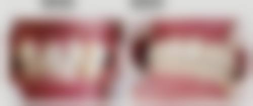 服务流程与患者保护：从预约到术后全程贴心