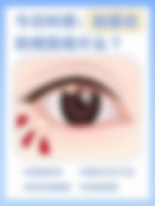 优惠活动详情：准分子激光原价8000元-优惠价5600元
