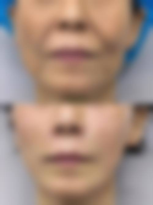 结语：正规机构 + 专精团队 + 限时优惠，立即预约改变