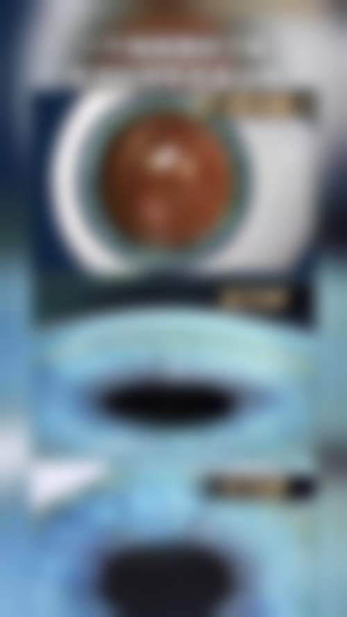 设备与环境:数字化精细诊疗的硬件支撑