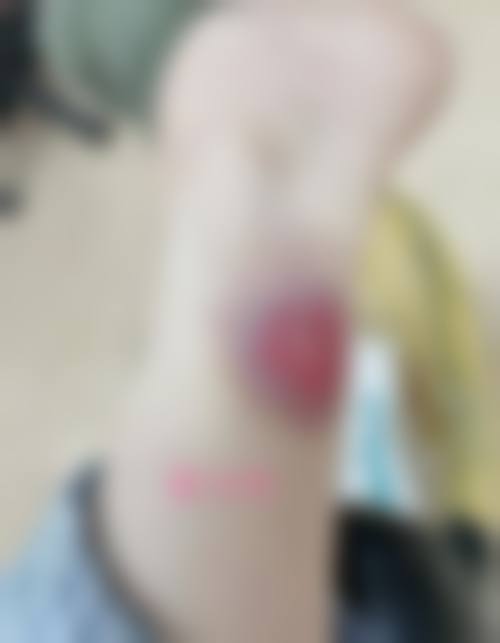 服务流程与患者保护:从预约到术后无忧