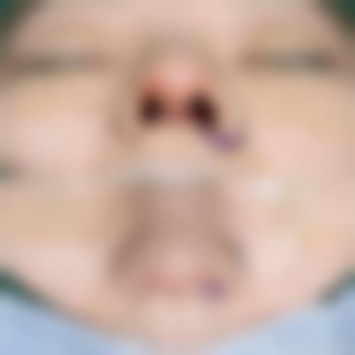 患者真实评价