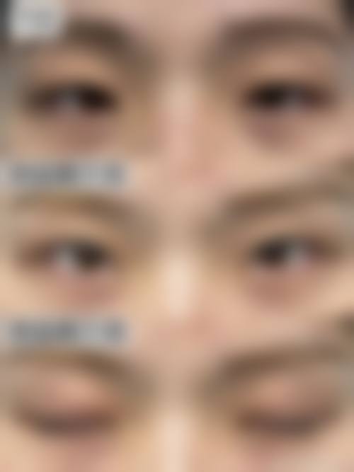 临床实例分享