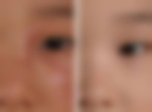 擅长项目详解