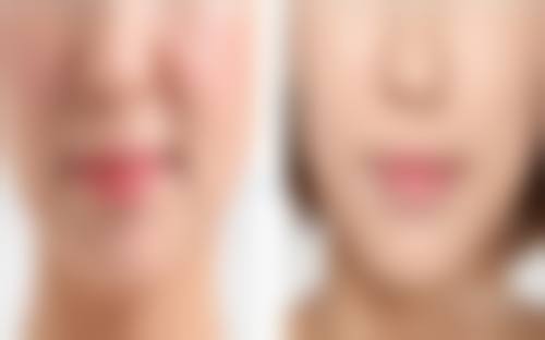 临床实例分享