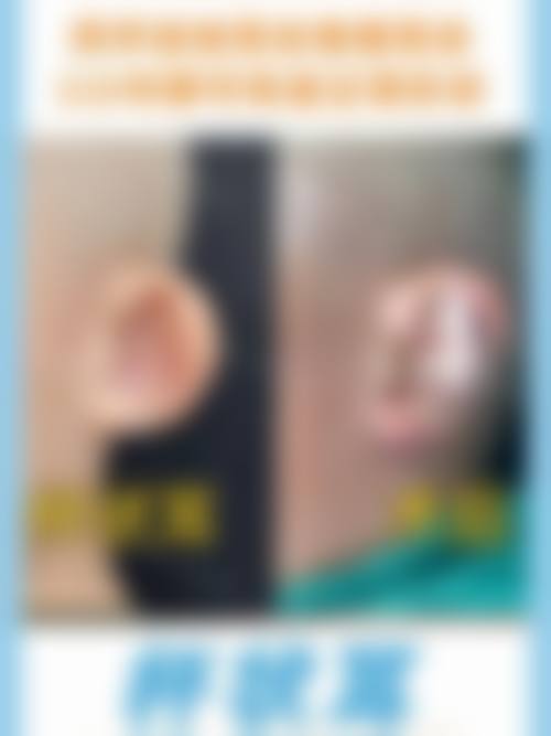 常见问题解答