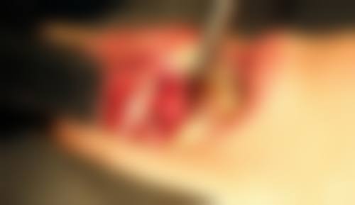 优惠活动详情:热门项目限时特别优惠