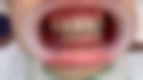 临床实例分享:真实实例见证技术实力