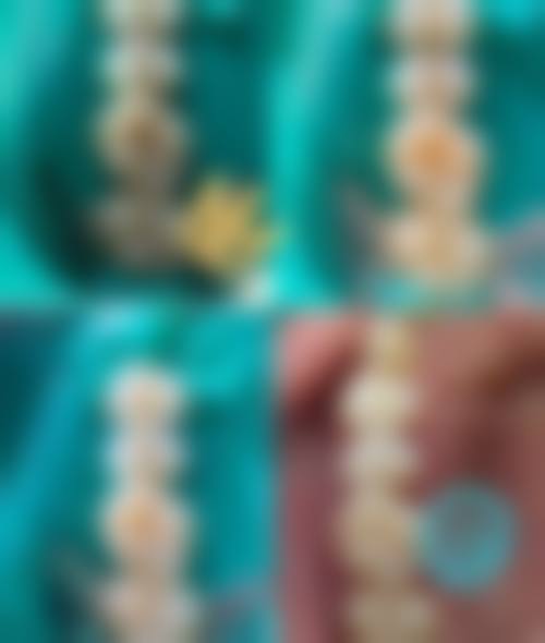 擅长项目详解:精细匹配各类口腔需求