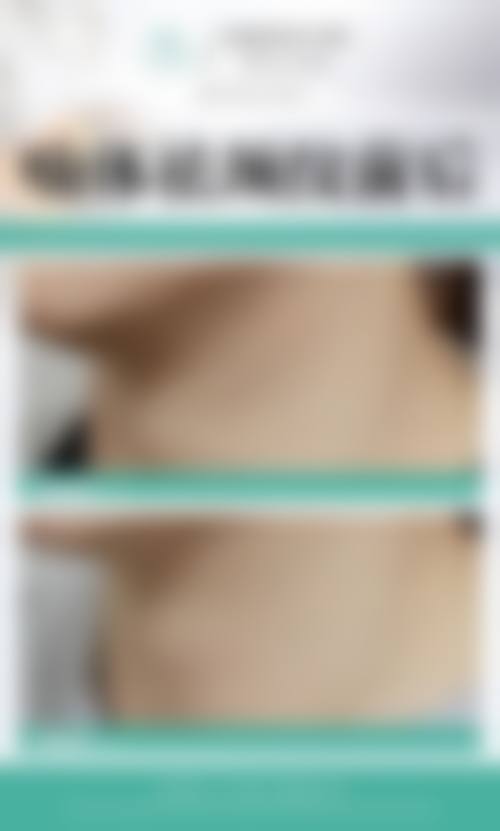擅长项目详解