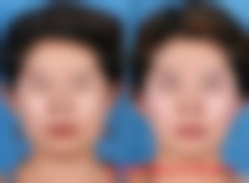 临床实例分享