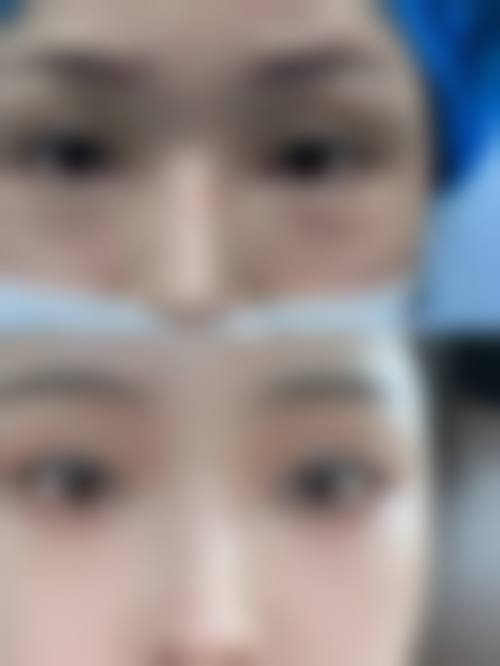 诊疗特色总结 王力佳 广州南珠整形美容 五官整形