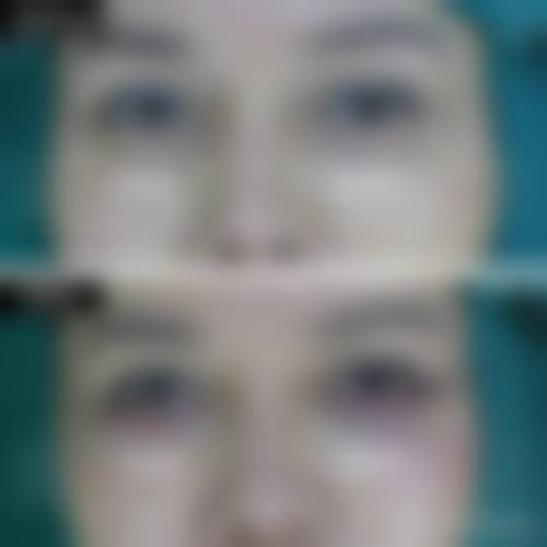 预约优惠活动 王力佳 广州南珠整形美容