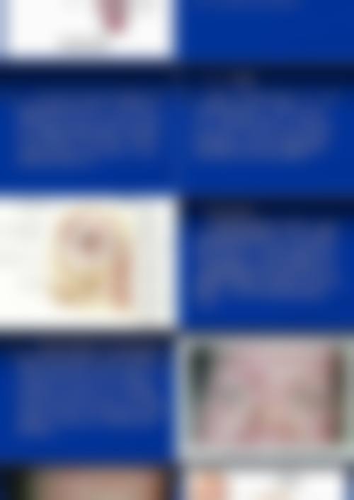 特色科室与项目:精细解决眼健康需求