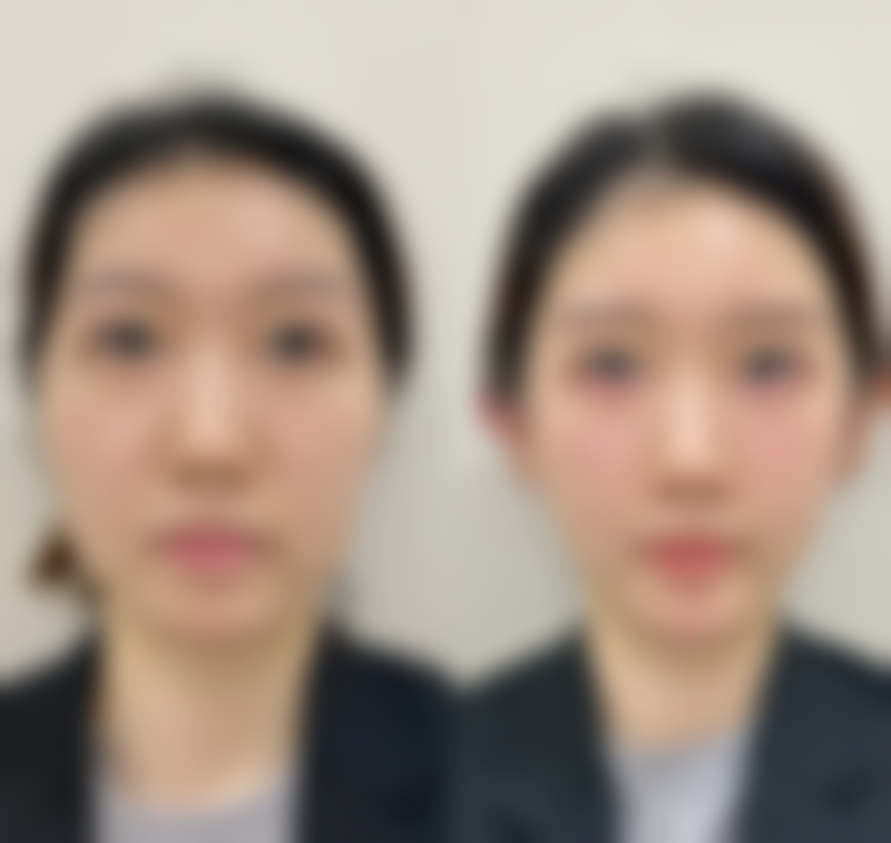 特色项目与价格优惠:隆胸、吸脂等重点项目介绍