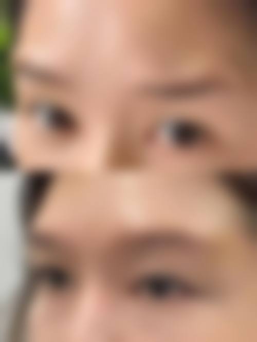 优惠活动详情:热玛吉限时特价,其他项目同步让利