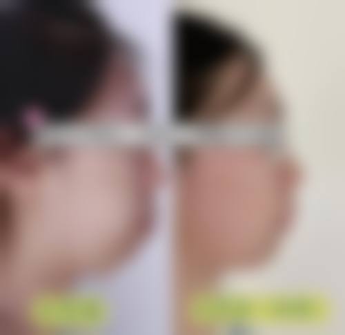 优惠活动详情：如何享受性价比？