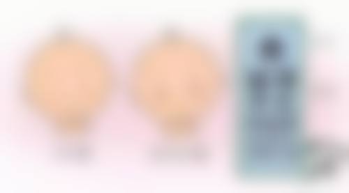 临床实例分享