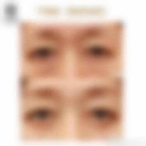 结语与预约号召