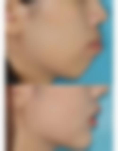 常见问题解答