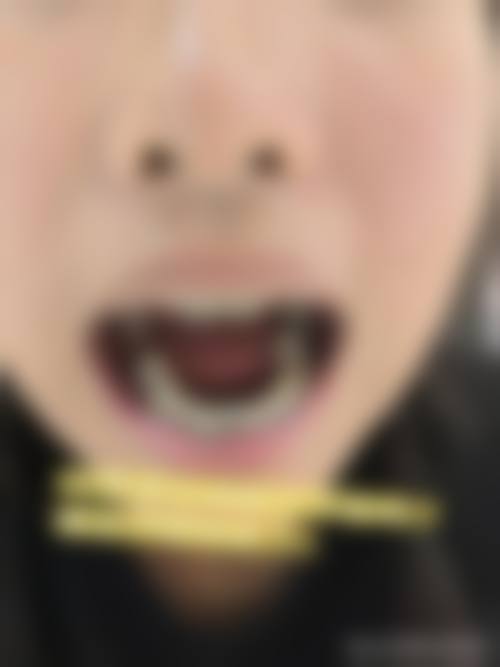 优惠活动详情